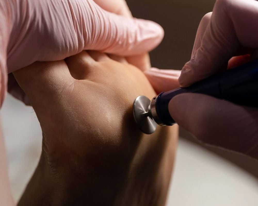 Hard skin refined with an electric file at Blanche Beauty